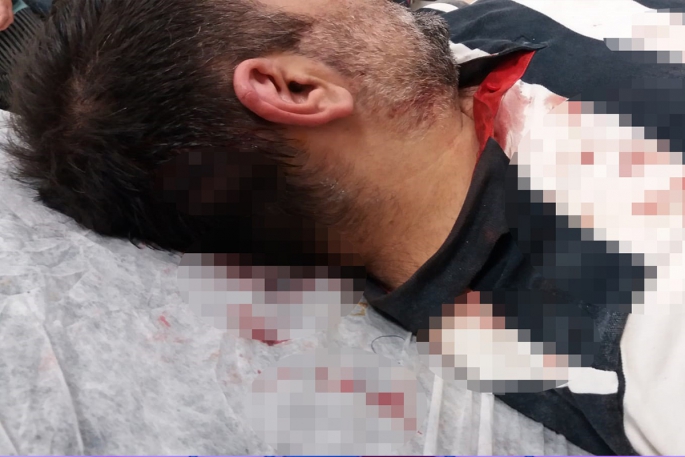 Büyükada'da kaçak inşaatı görüntülemek isteyen gazeteciye kazma kürek ile saldırdılar