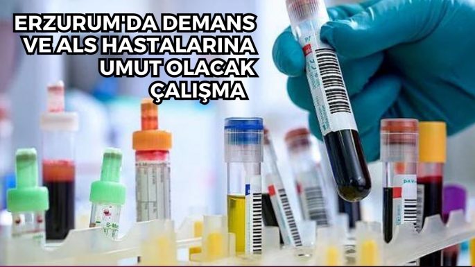 Erzurum'da Demans ve ALS hastalarına umut olacak çalışma 