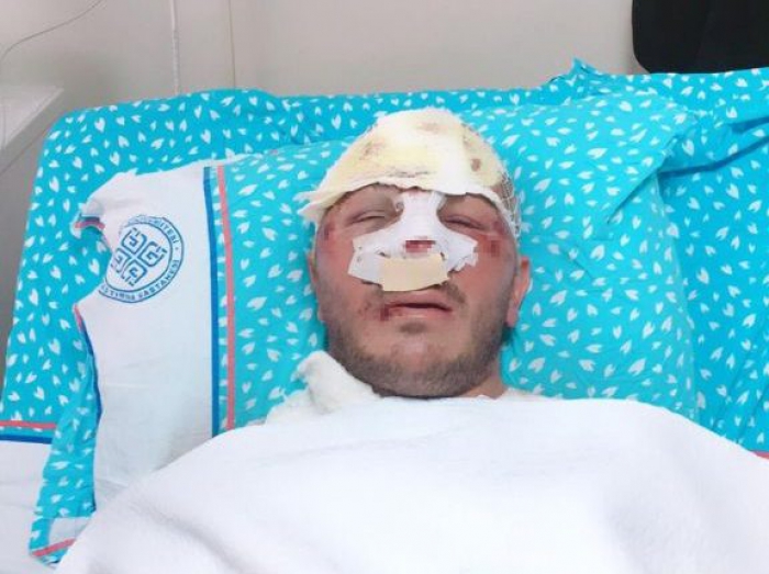 Erzurum’da  Motosiklet sürücüsü dehşeti yaşandı