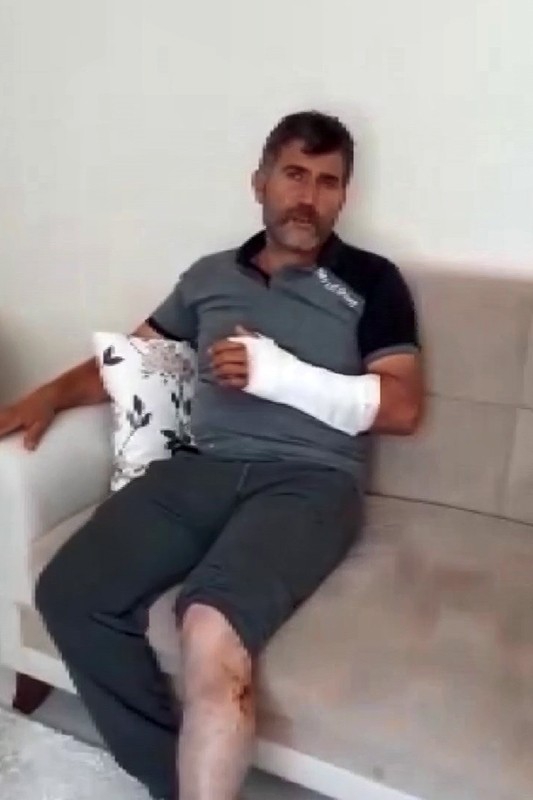 Erzurum'da öldüğü sandığı ayı saldırdı güreşerek hayatta kaldı