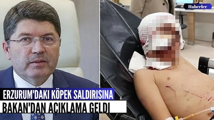 Erzurum'daki köpek saldırısına Bakan'dan açıklama geldi