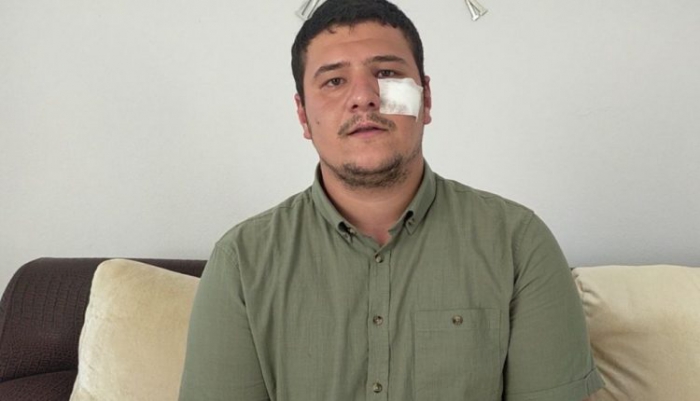 İHA muhabirini darp eden saldırganların ifadeleri pes dedirtti