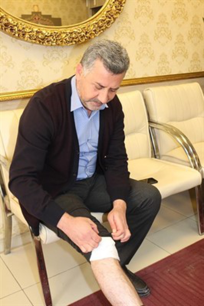 Kaldırım taşının azizliğine uğradı ayağına altı dikiş atıldı
